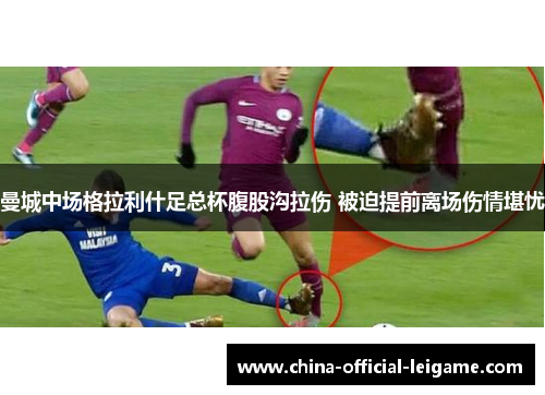 曼城中场格拉利什足总杯腹股沟拉伤 被迫提前离场伤情堪忧